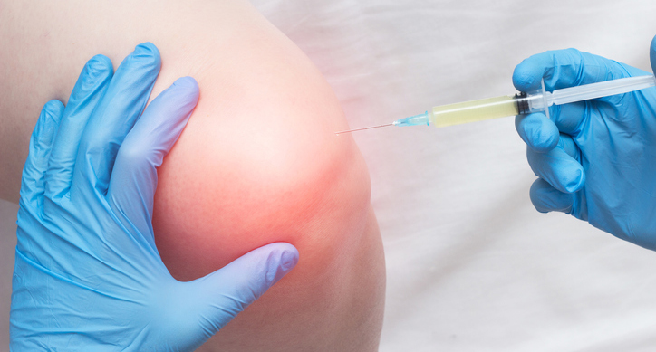 EPIDURAL STEROID INJECTIONS
